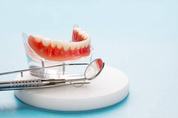 Dental Inlays and Onlays in Tashua, CT